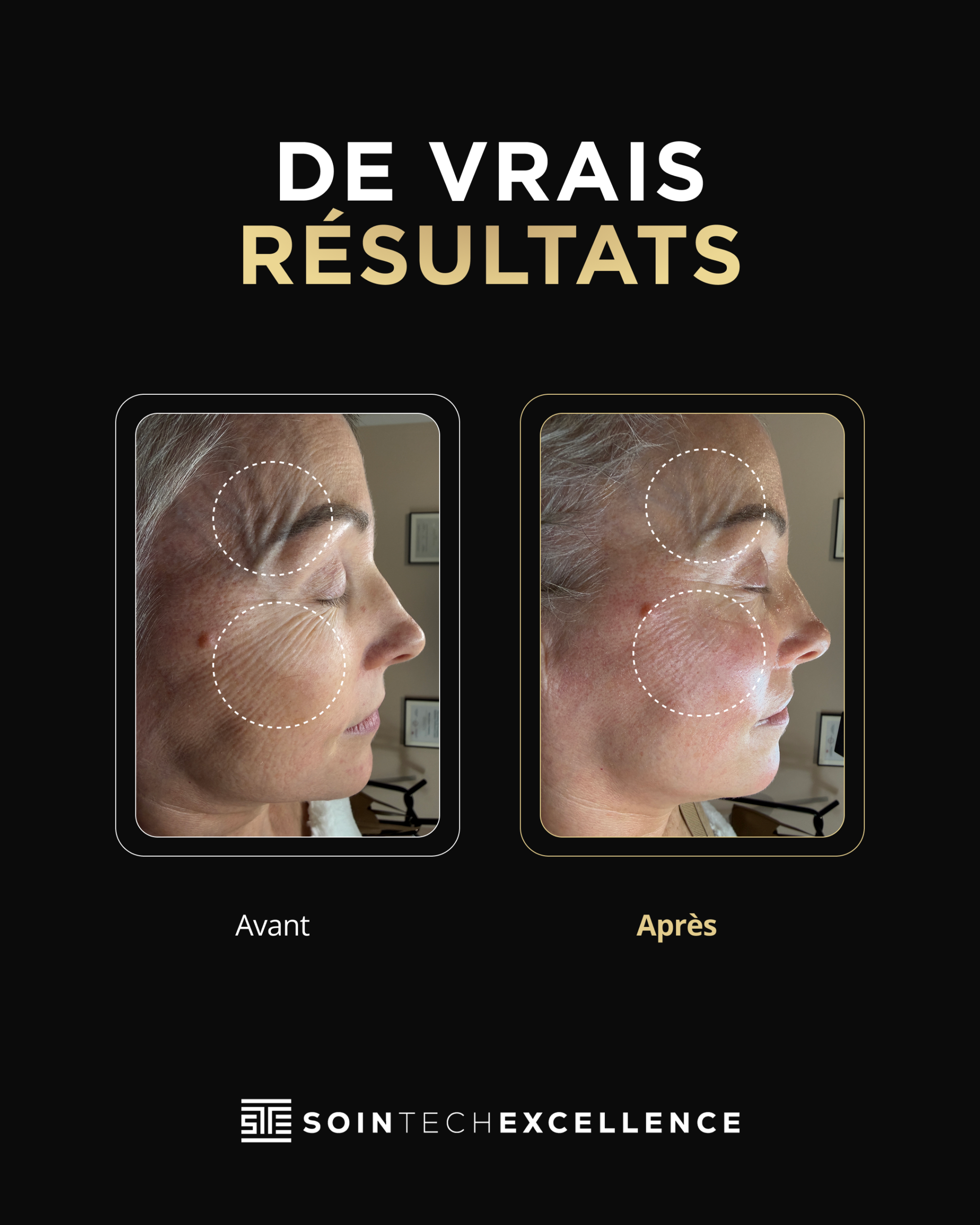 Avant / Après
